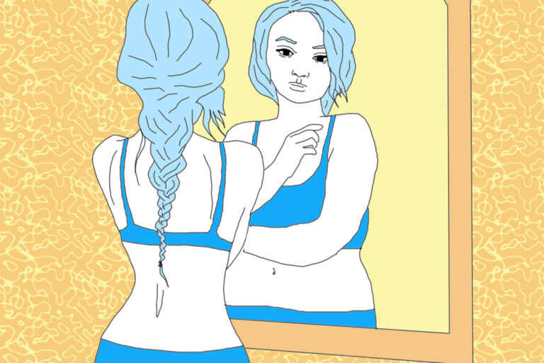 Body Dysmorphia after Weight Loss Surgery